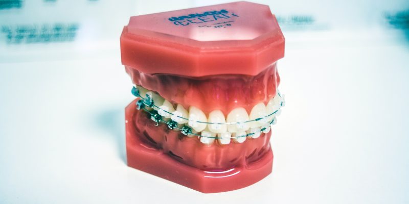 Dental Invisalign