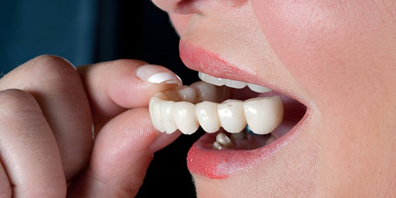 Maintaining Comfort with Dentures: Top Tips for Farmington, NM Residents to Prevent Gum Irritation
